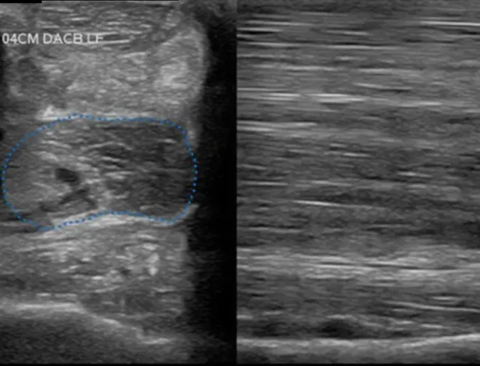Ultrasound of a Horse with Ligament Injury
